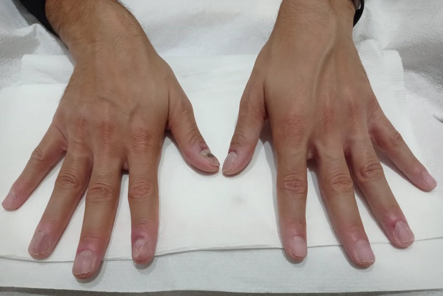 unghiedauomo

CHI HA DETTO CHE UN UOMO NON PUÒ FARE UN MANICURE O IL SEMIPERMANENTE? 

La nostra Anna ha realizzato per il nostro cliente un semipermanente sul naturale con un dettaglio particolare 🩷

 💅🏻 Cosa aspetti?
Scopri i nostri servizi e prenota il tuo appuntamento

httpswwwparrucchiere-estetistait

Tel 059926258

Via Francesco Bertelli 911 41013 Castelfranco Emilia Modena Emilia-Romagna Italia

nails nailsofinstagram nailart glitternails nailsoftheday acrylicnails gelnails longnails  nailsnailsnails nailtech ombrenails naildesign shortnails naildesigns nudenails manicure naturalnails nailartist coffinnails instanails nailstagram gel nailsart  uomo man